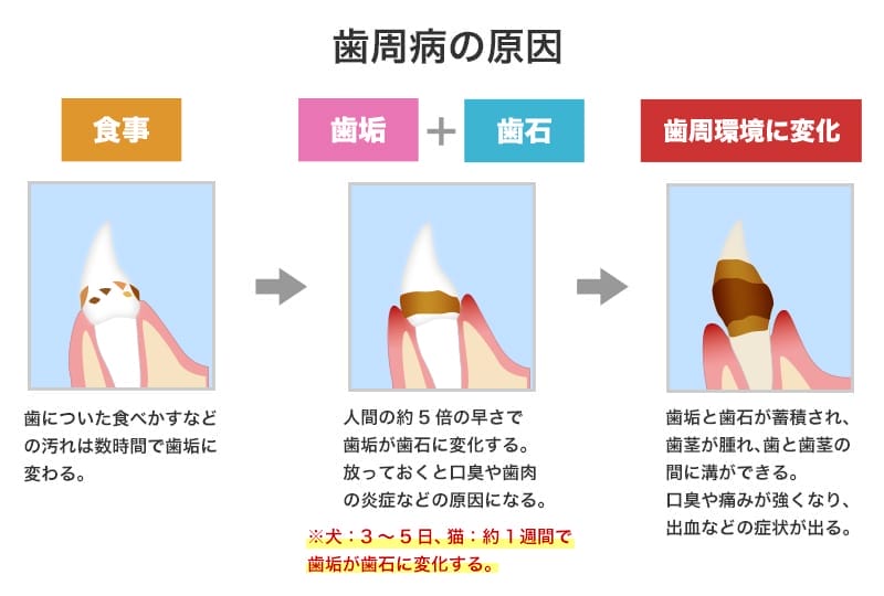 歯周病のリスク